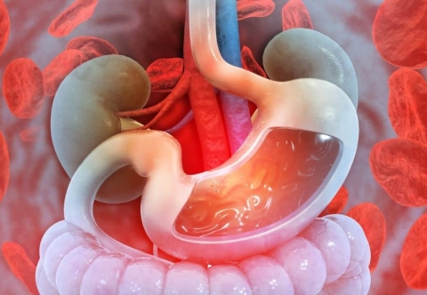 Đau dạ dày lâu năm là bệnh lành